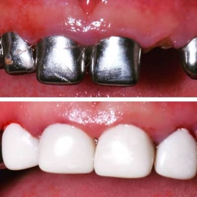 Slider image (1) Infantident